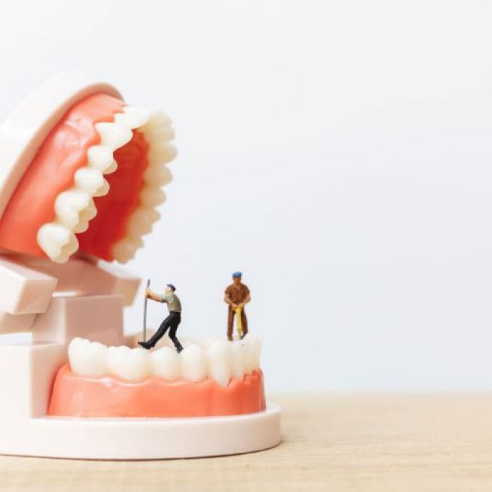 Dentures
